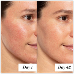 Sunday Riley A+ High-Dose Retinoid Serum 1.7 oz