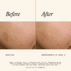 SkinMedica Even and Correct Dark Spot Cream 0.5 oz