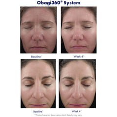 Obagi Medical Retinol 1.0 (1 oz.)
